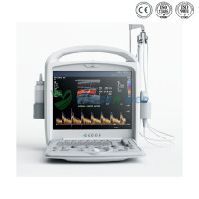 Ysb-V3 Medical Diagnostic Portable Color Doppler Ultrasound Scanner